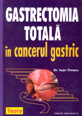 UZATA - Gastrectomia totala in cancerul gastric
